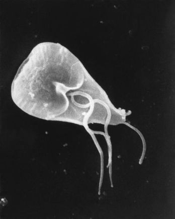 479px-Giardia_lamblia_SEM_8698_lores